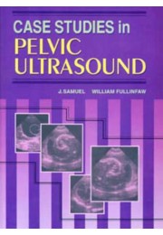 CASE STUDIES IN PELVIC ULTRASOUND CASE STUDIES IN PELVIC ULTRASOUND